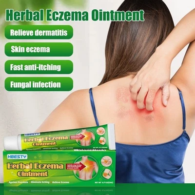 20G Hierbas Eczema Ungüento Piel Uso Externo Crema para Eczema Prurito - Imagen 1 de 4