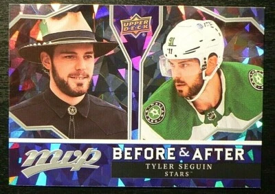 2021-22 21-22 Upper Deck MVP Before & After BA-3 Tyler Seguin Dallas Stars - Image 1 of 2