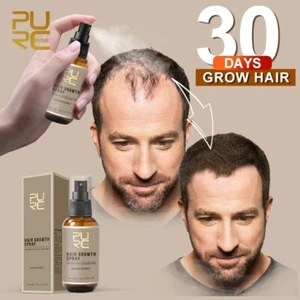 30ml Hair Growth Spray Extract Prevent Hair Loss Growing Hair For Men Hot - Picture 1 of 7