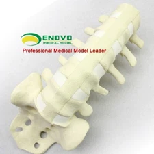 Simulated bone, Lumbar vertebra, Medical Orthopaedic Operative Training Model