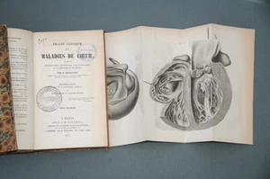 Médecine Cardiologie J.Bouillaud Traité clinique des maladies du cœur 1841 - Picture 1 of 8