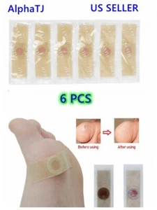 6) BEST Foot Corn Remover Pads Plantar Wart Plaster Patch Callus Removal USA - Picture 1 of 7