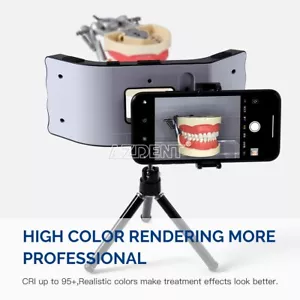 Suplementario de fotografía oral dental con equipo de luz de llenado de soporte - Imagen 1 de 22