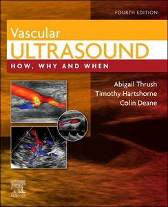 Vascular Ultrasound - Foto 1 di 1