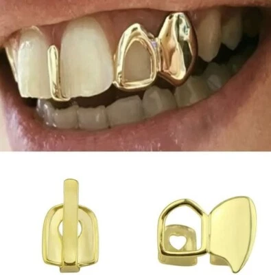 Custom 14K Gold Plated Upper Top Teeth Left Side Open Face Fangs + Gap Grillz - Image 1 of 2