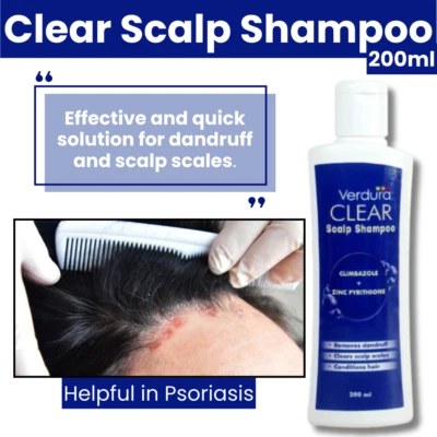 Clear Scalp Psoriasis Shampoo: Anti-Dandruff. Helps with Eczema, Dry Itchy Scalp - Image 1 of 4