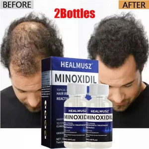 2 Meses Extras Fuerza Unisex Tratamiento de Recrecimiento Recuperar Crecimiento del Cabello Solución - Imagen 1 de 19