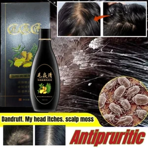Scalp Hair Follicle Shampoo Antibacterial Anti-Itching Mites Oil Control-US 2025 - Picture 1 of 19