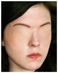 NIÑA SIN OJOS - PRÓTESIS - FOTOGRAFÍA 4"X5" - Imagen 1 de 1