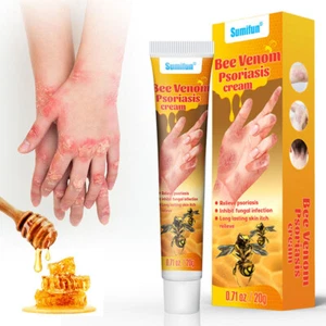 Bienengift Psoriasis Creme zur Linderung von Dermatitis Psoriasis juckende Haut - Bild 1 von 11