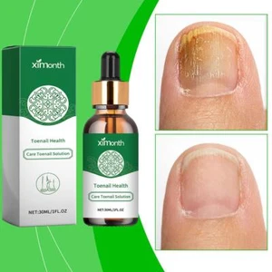 30ml Antibacterial Fungal Nail Treatment Liquid Nail Repair Essential Serum 2024 - Picture 1 of 12