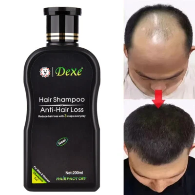 200ml Regeneration Regrowth Hair Growth Shampoo Natural Anti Hair Loss Treatment - Image 1 of 4