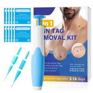 2in1 Schmerzlos Auto Haut Tag Maulwurf Warze Entfernung 40x Gummiband 10x Alkoholtupfer - Bild 1 von 18