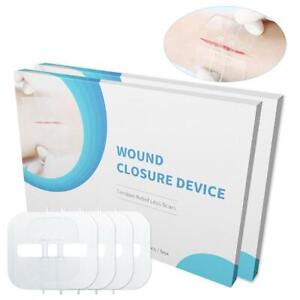 4 dispositifs de fermeture à glissière pour coudre - solution efficace de premiers soins d'urgence