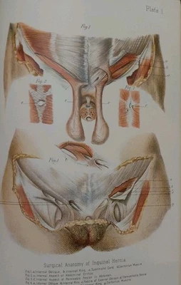 Rare unique Antique Medical Book Old! Lithographs Oddities Diseases Freaks - Image 1 of 4