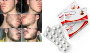 Men Beard Growth Supplement Fuller & Thicker Hair With Vitamins (30 Tablets) - Picture 1 of 6