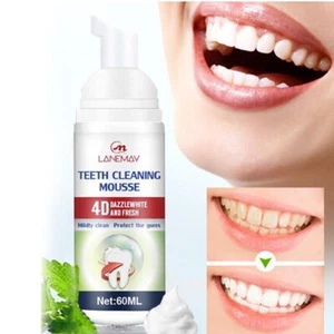 Zahnstein-Entfernung Zahnpasta Oral Reinigung Bleaching Mous , - Bild 1 von 11