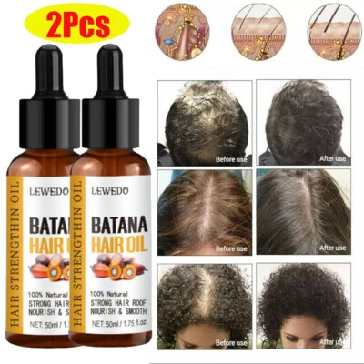 2X Suero Natural Crecimiento del Cabello Denso Regeneración Aceite Batana Suero Tratamiento Antipérdida Foto 1 de 4