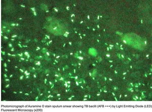 Auramine O dye for microscopy || CAS: 2465-27-2 || 250 g || dye content: 80% - Foto 1 di 4