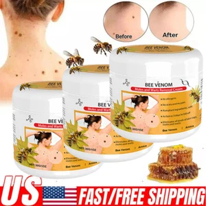 Bee Venom Skin Tag Removal Treatment Cream Body Care Mole Corn Wart Remover US - Picture 1 of 17