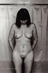 1982 Vintage Female Nude Stitches Scar HELMUT NEWTON Wife June Photo Art 11X14 - Picture 1 of 1