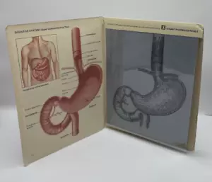 Ayuda médica promocional Mylanta para el tracto gastrointestinal superior escritura y transparente 11"x8,5" - Imagen 1 de 7