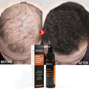 Hair Growth Spray Serum Ginger Anti Hair Loss Fast Grow Essence Care Products