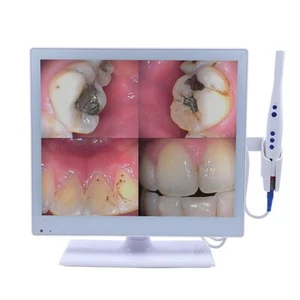 Cámara intraoral dental con cable con monitor LED de 17 pulgadas M-978 HDMI USB VGA 2 en 1 - Imagen 1 de 12