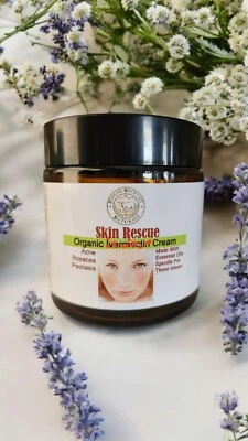 Organic Topical Skin Rescue! Psoriasis, Acne Rosacea Parasite Problem Cream - Image 1 of 4