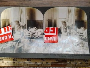 Antique Stereoview Card - WW 1 - Injured Deformed Face VERY WARNING GRAPHIC - Picture 1 of 1