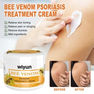 30G Bee Venom Cream Repair Hand Foot Skin Redness Smoothing Skin Care Cream - Picture 1 of 15