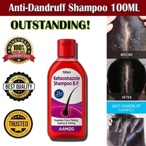 AAMZG  Anti-Dandruff Shampoo, Treat & Prevent Dandruff - 100ml Clean Hair - Picture 1 of 9