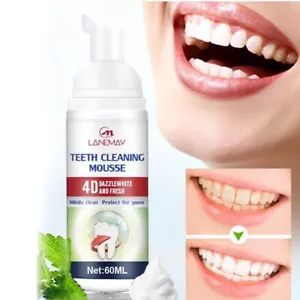 Mousse Zahnpasta Bleaching Zahnstein-Entfernung Oral Reinigung/s - Bild 1 von 11