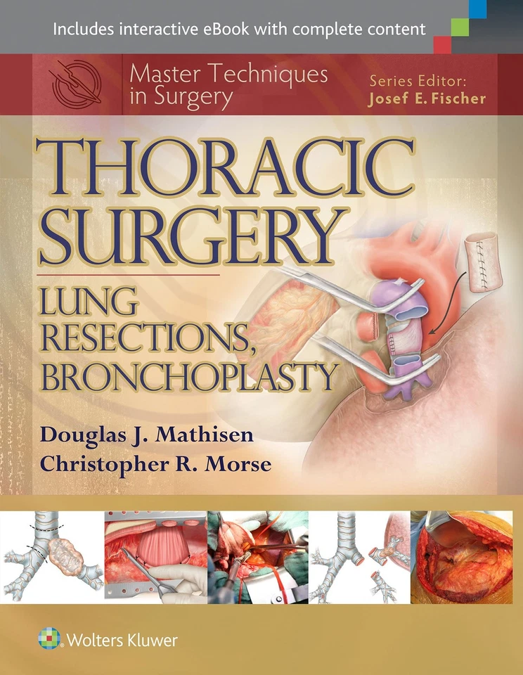 Master Techniques in Surgery: Thoracic Surgery: Lung Resections, Bronchoplas... - Image 1 of 1