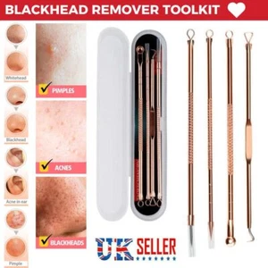 4x Blackhead Remover Tool Kit Spot Popper Comedon Acne Pimple Extractor - Picture 1 of 12