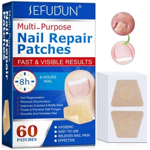 Nail Repair Patches | Foot Nail Stickers Fast | Visible HOT Results SALE Z5D3 - Bild 1 von 15