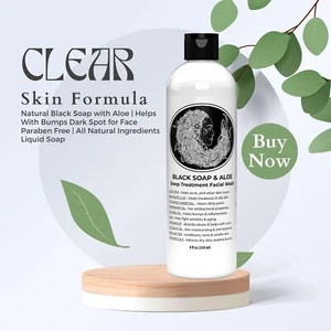 Acne Soap for Face and Body: A Comparison - Picture 1 of 10