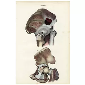 Stupenda incisione folio 1822 JOHN LIZARS colorata a mano: PL. XLVII, ARTICOLAZIONE ANCA - Foto 1 di 5