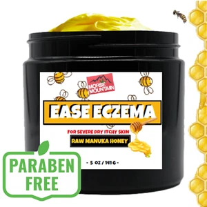 Raw Manuka Honey Cream - Great for Babies Eczema Rosacea Dermatitis Skin Relief - Picture 1 of 6