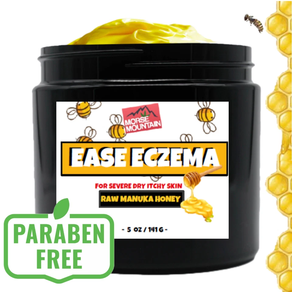 MORSE MOUNTAIN Raw Manuka Honey Cream - Great for Babies Eczema Rosacea Dermatitis Skin Relief