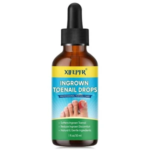 Ingrown Toenail Treatment Ingrown Toenail Reliever and Softener for Easy Trim... - Picture 1 of 8