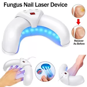 Nail Fungus Laser-Device Light Therapy Onychomycosis Toes Treatment For Home Use - Picture 1 of 18