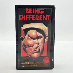 SELTEN Being Different VHS Vestron Circus Freaks Harry Rasky Dokumentarfilm Clamshell - Bild 1 von 7