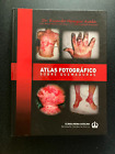 Atlas Fotografico: Sobre Quemaduras Dr. Ricardo Manzur Ayala Hardcover