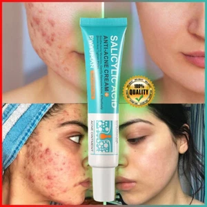 ✅Crema facial para tratamiento de acné con ácido salicílico reparación manchas de granos limpieza profunda de poros - Imagen 1 de 10
