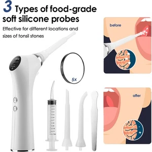 Electric Tonsil Stone Remover w/ 3 Suction Modes, 5x LED Magnifier & Probes - Picture 1 of 14