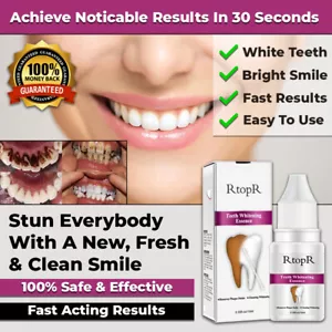 NEW INSTANT TOOTH WHITENING KIT WHITE TEETH CLEAN GEL UV BLEACH DENTAL STRENGTH - Picture 1 of 9
