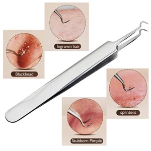 Stainless Steel Acne Remover Curved Tweezer Blackhead Extractor Clip Tool - Picture 1 of 17