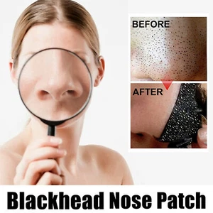 10 X Nose Pore Cleansing Strips|Reduzierung Von überschüssigem Öl - Bild 1 von 12
