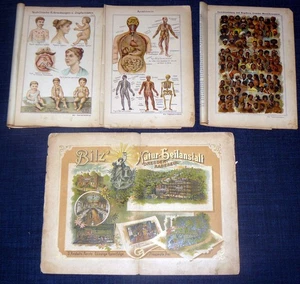 Impfschäden Syphilis Anatomie Gesichtsbildungen Bilz's Natur-Heilanstalt 1894 - Bild 1 von 1